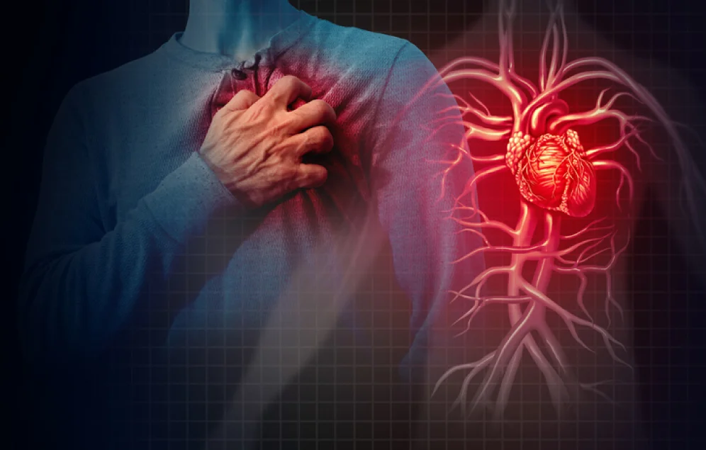 Un hombre se agarra el pecho con gesto de dolor, superpuesto a una ilustración resaltada de un corazón y vasos sanguíneos. La imagen sugiere la relación entre el malestar físico y un posible evento cardíaco. Esto ilustra cómo el estrés puede desencadenar problemas del corazón.